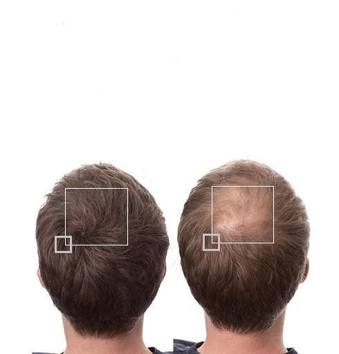 Sérum Croissance Cheveux Romarin - Stoppez la chute, stimulez la pousse!
